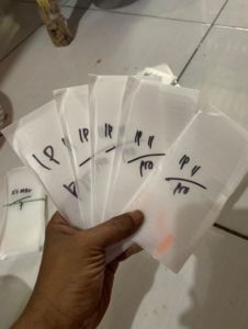 Iphone 11pro