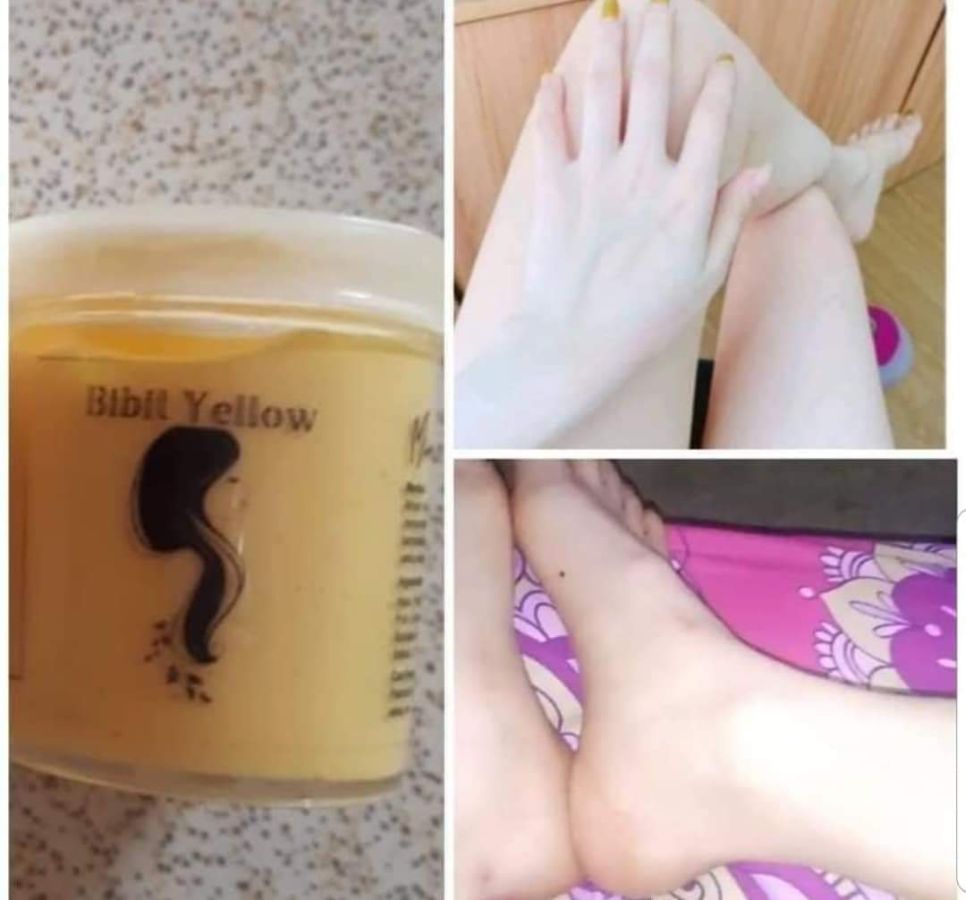 Bibit yellow 