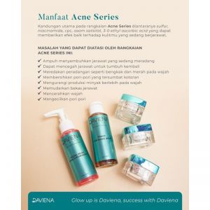 ACNE SERIES DAVIENA SKINCARE
