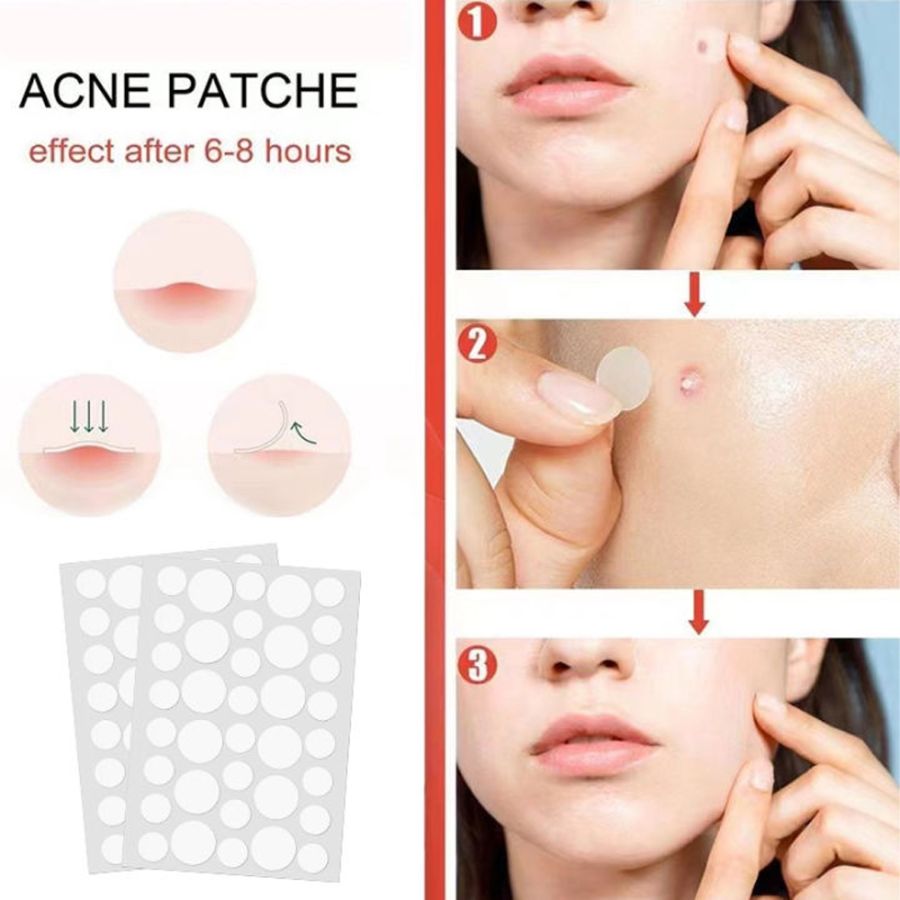 Spot Patch Acne Treatment Day Penghilang Jerawat