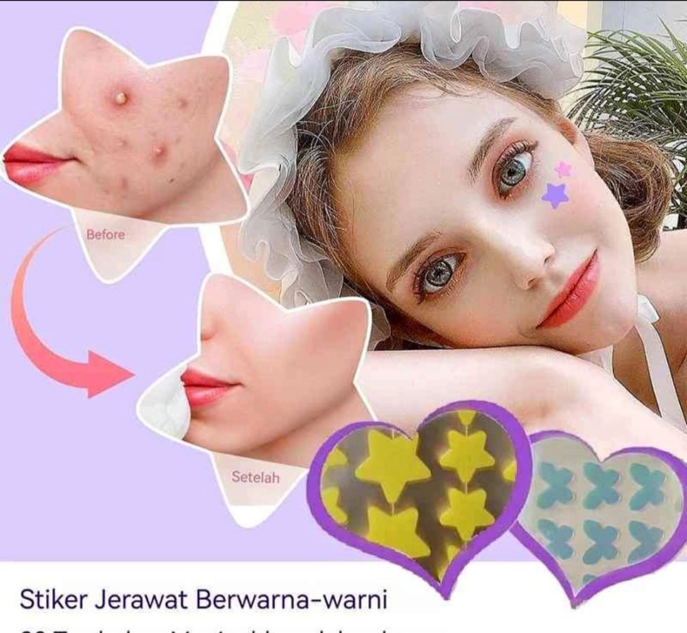 Stiker jerawat(ready)